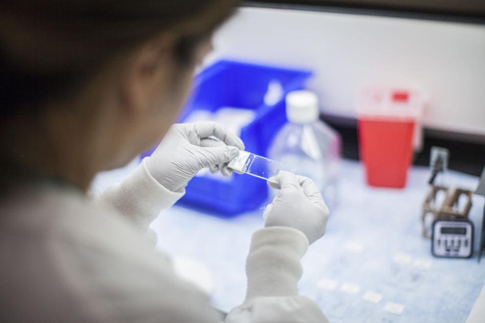 Oncotype DX Breast Recurrence Score tests are processed in Exact Sciences’ lab in Redwood City, California.