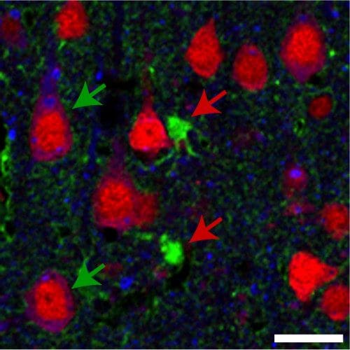 This image shows a section of brain tissue from a rat that received a gene therapy targeting the Trk-fused gene. A mutation in that gene is implicated in the development of certain motor neuron diseases. Green arrows highlight neurons expressing elevated levels of the gene following the therapy. Red arrows indicate other nerve cells called astrocytes that lack increased expression. Image courtesy of Anjon Audhya/UW–Madison