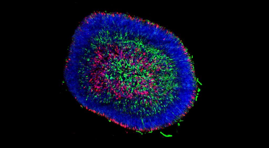 retinal-organoid-image