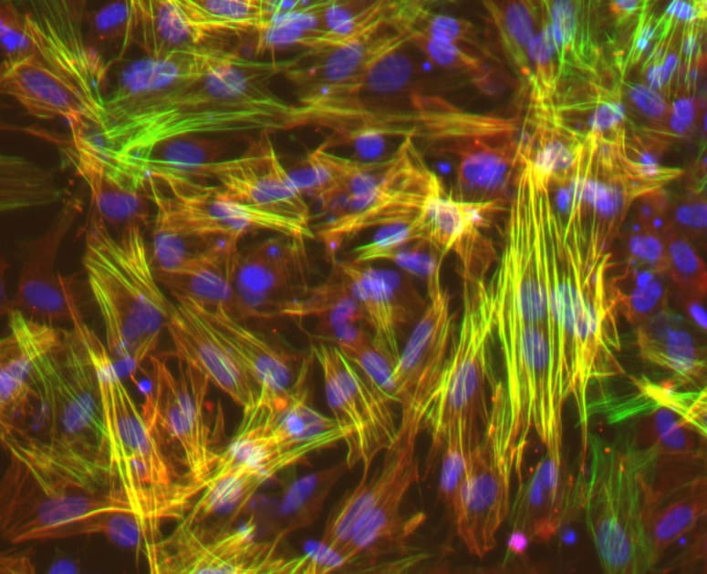 UW–Madison researchers studied smooth muscle cells like these, derived from induced pluripotent stem cells, to show that long-mysterious variations in an area of our genome harden blood vessels, puting some people at higher risk for cardiovascular disease. Image courtesy Lo Sardo Lab/UW–Madison