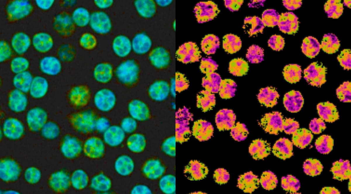 eutrophils-omi-featured