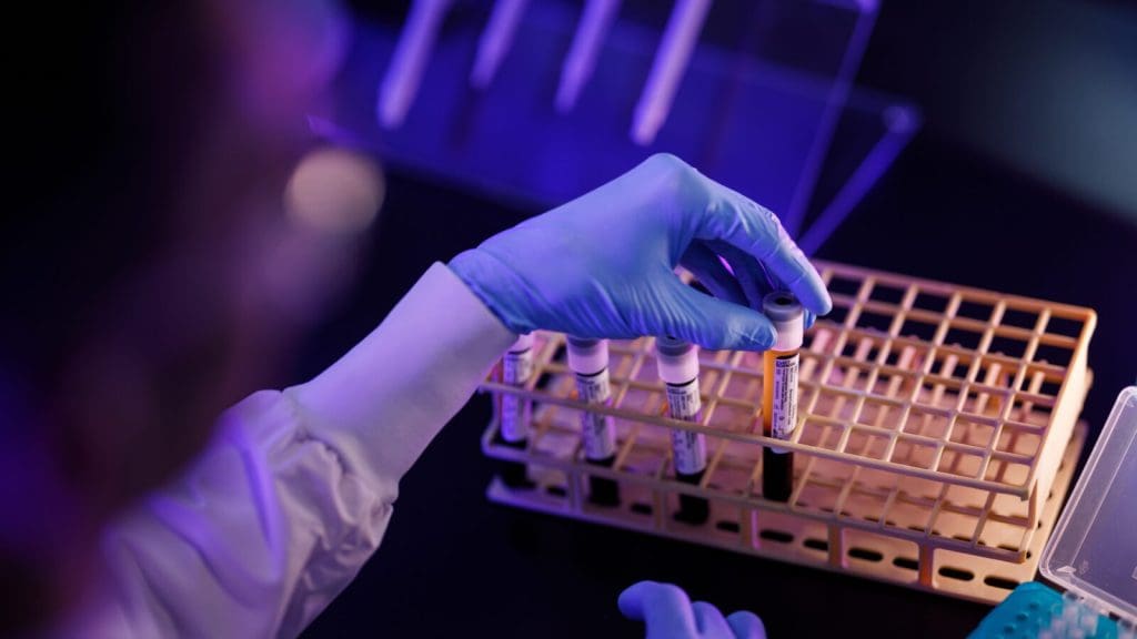 Lab technician lifting vial